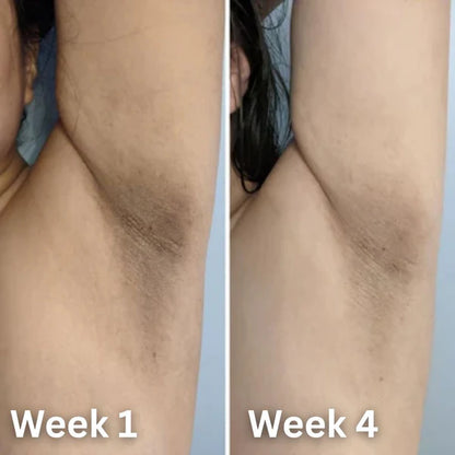 Amorivra® Skin Brightening Deodorant