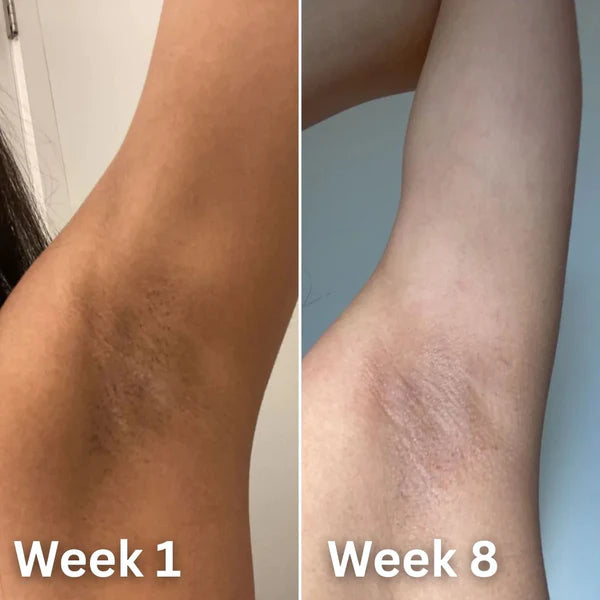 Amorivra® Skin Brightening Deodorant