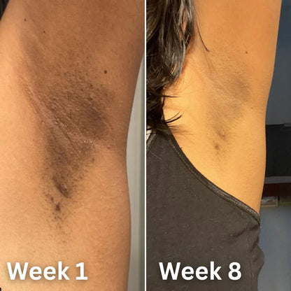 Amorivra® Skin Brightening Deodorant